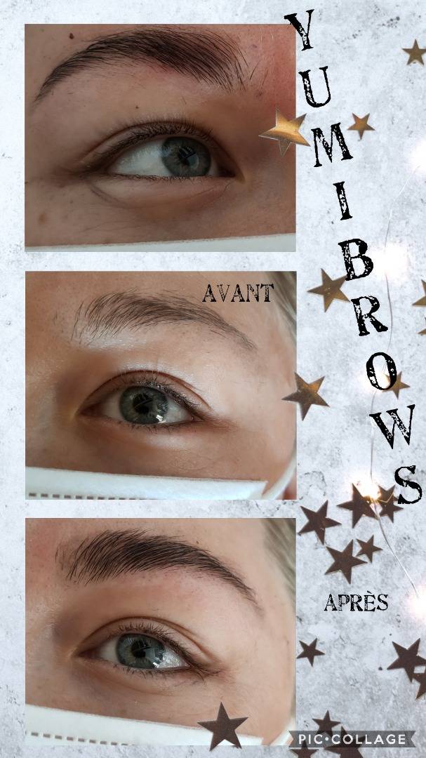 Restructuration-sourcils1