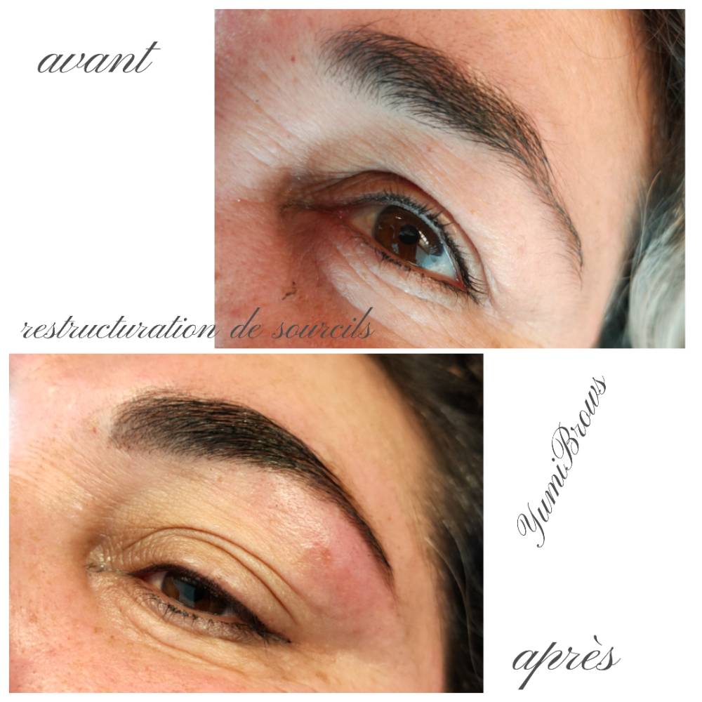 Restructuration-sourcils3